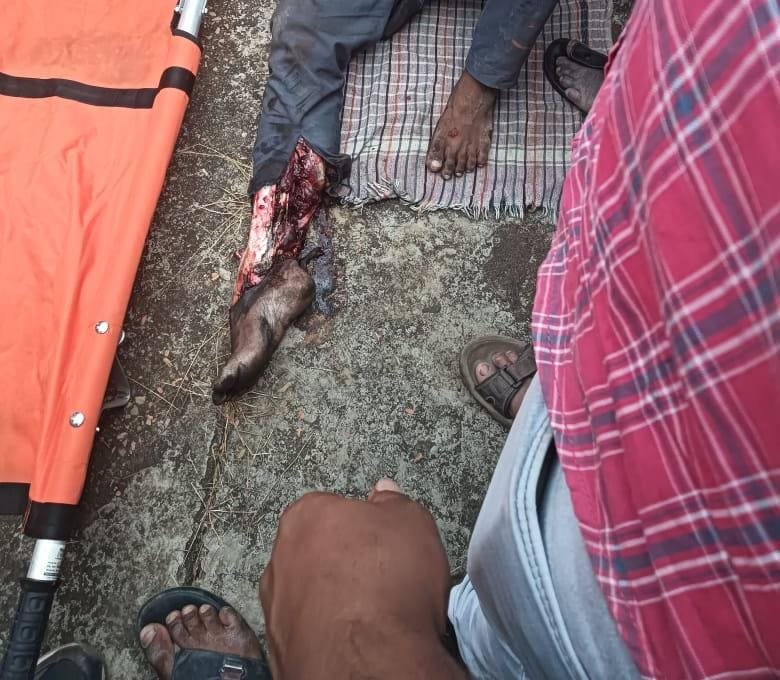 రైలు ఎక్కే ప్రయత్నంలో ప్రమాదం.. విద్యార్థికి తీవ్ర గాయాలు