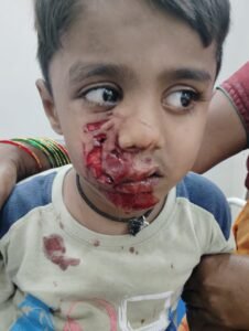 నల్గొండ జిల్లా నకిరేకల్ లో పిచ్చికుక్కల స్వైర విహారం