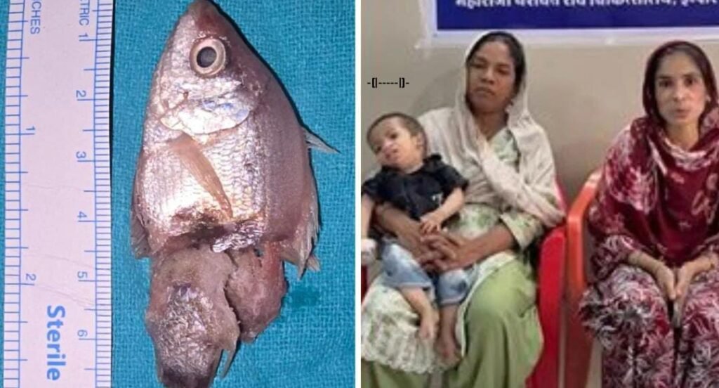 బతికున్న చేపను మింగిన ఏడాది బాలుడు