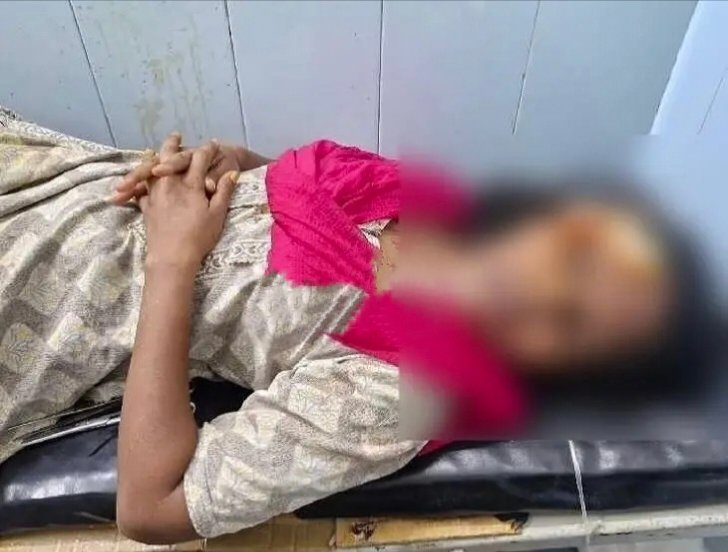 మదనపల్లి లో కోడలిపై అత్తమామల దాడి