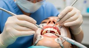 దంత వైద్యశాలలో స్వీపర్‌తో చికిత్స!