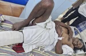 తంబళ్లపల్లెలో రోడ్డు ప్రమాదం – రైతుకు తీవ్ర గాయాలు