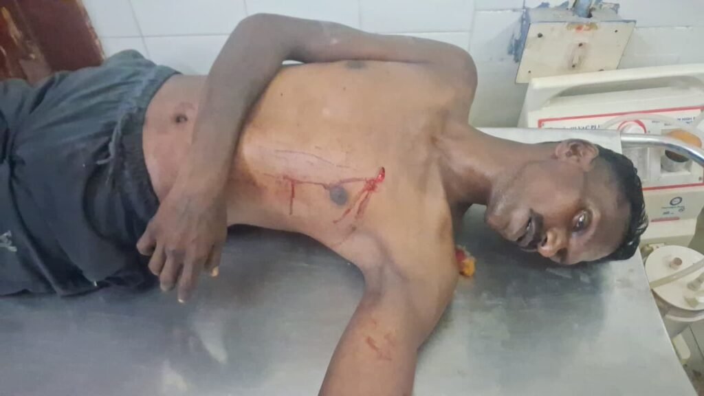 టమోటలు తరలింపులో ఘర్షణ