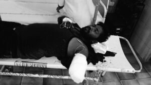 కాంక్రీటు మిల్లర్ మీదపడి కార్మికుడి చేయి తెగింది.