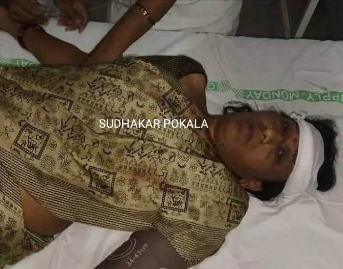 బస్సు నుంచి జారిపడి మహిళకు తీవ్ర గాయాలు