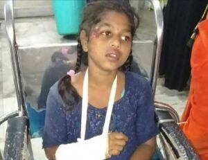 మిద్దెపై నుంచి జారిపడి బాలికకు తీవ్ర గాయాలు