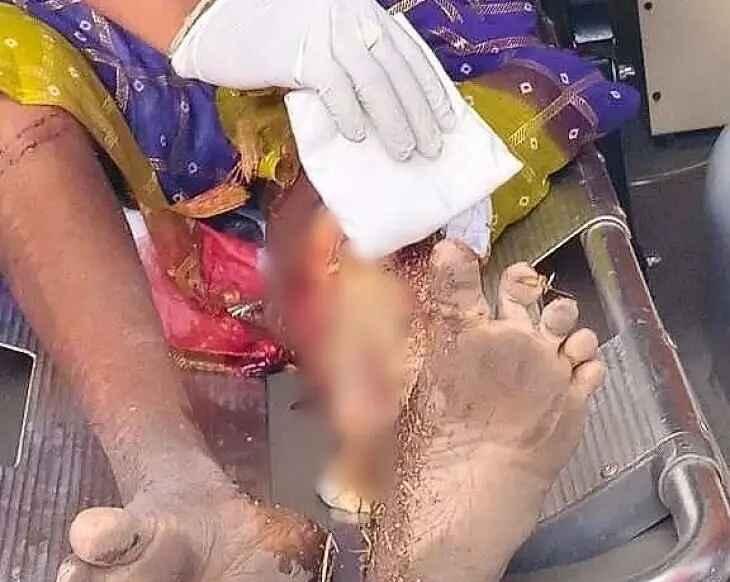 కలికిరిలో ఆర్టీసీ బస్సు ఢీకొని వృద్ధురాలికి తీవ్ర గాయాలు