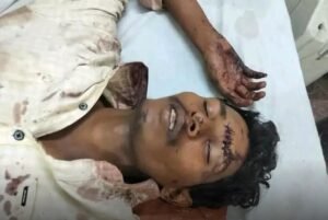 సత్తెనపల్లి వద్ద రైలు ఢీకొని యువకుడికి తీవ్ర గాయాలు