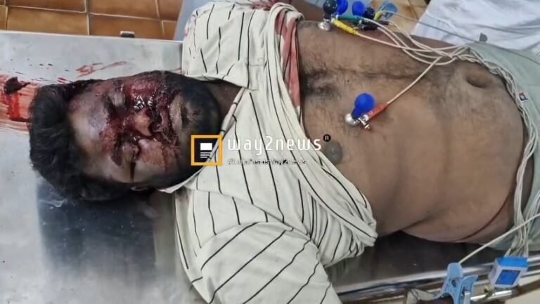 మదనపల్లి లో రోడ్డు ప్రమాదం యువకుడు స్పాట్ డెడ్