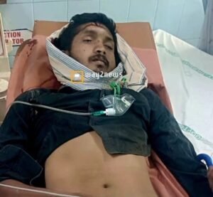 మదనపల్లె బైపాస్ లో లారీ ఢీ కొట్టి యువకుడు పరిస్థితి విషమం