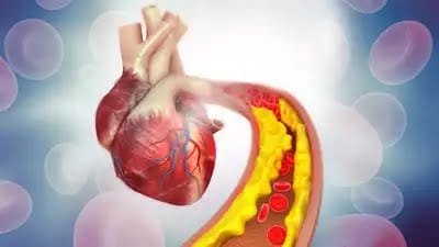 బాడీలో పెరిగిన కొలెస్ట్రాల్ తగ్గేందుకు ప్రతి రోజు తినాల్సిన ఏకైక పండు