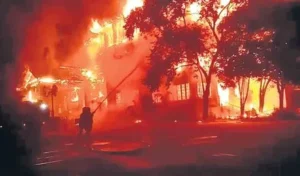 మంటల్లోచిక్కుని గాయపడిన ప్రతిభావంతురాలు