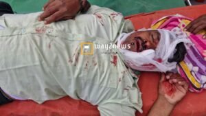 గుర్తుతెలియని వాహనము ఢీ కొట్టి పానీపూరి వ్యాపారికి తీవ్రగాయాలు