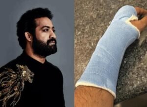 రేపు హీరో జూనియర్ ఎన్టీఆర్ కు సర్జరీ