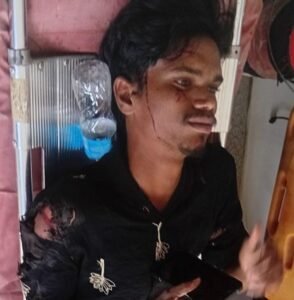 గుర్తుతెలియని లారీ ఢీకొని యువకుడికి తీవ్ర గాయాలు