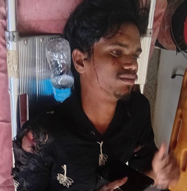 గుర్తుతెలియని లారీ ఢీకొని యువకుడికి తీవ్ర గాయాలు
